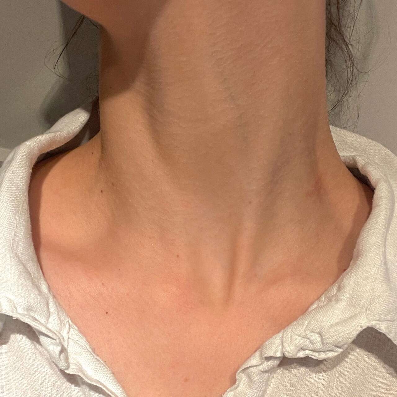 Image0